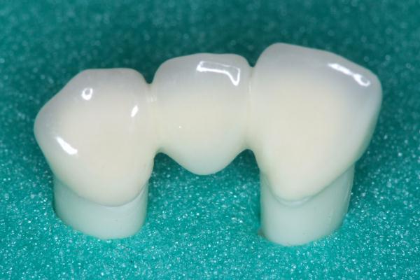 ハイブリッドセラミック